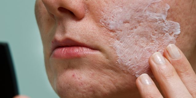 DIY Face Masks for Acne Scars
